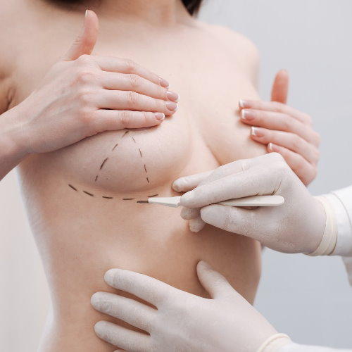 2020隆乳手術最新資訊完整揭露，消費者必看隆乳說明書