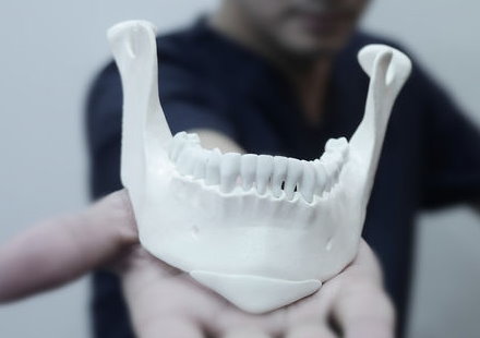 3D列印模擬墊下巴手術與3D列印模擬削骨手術3DMEDICAL與時俱進的醫療結合科技概念