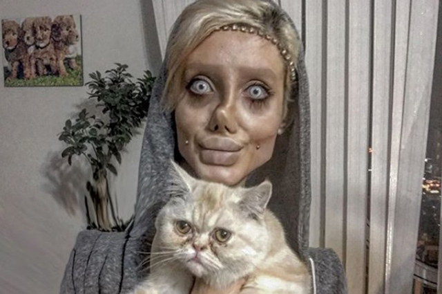 伊朗女想整成裘莉 整形50次變「殭屍臉」